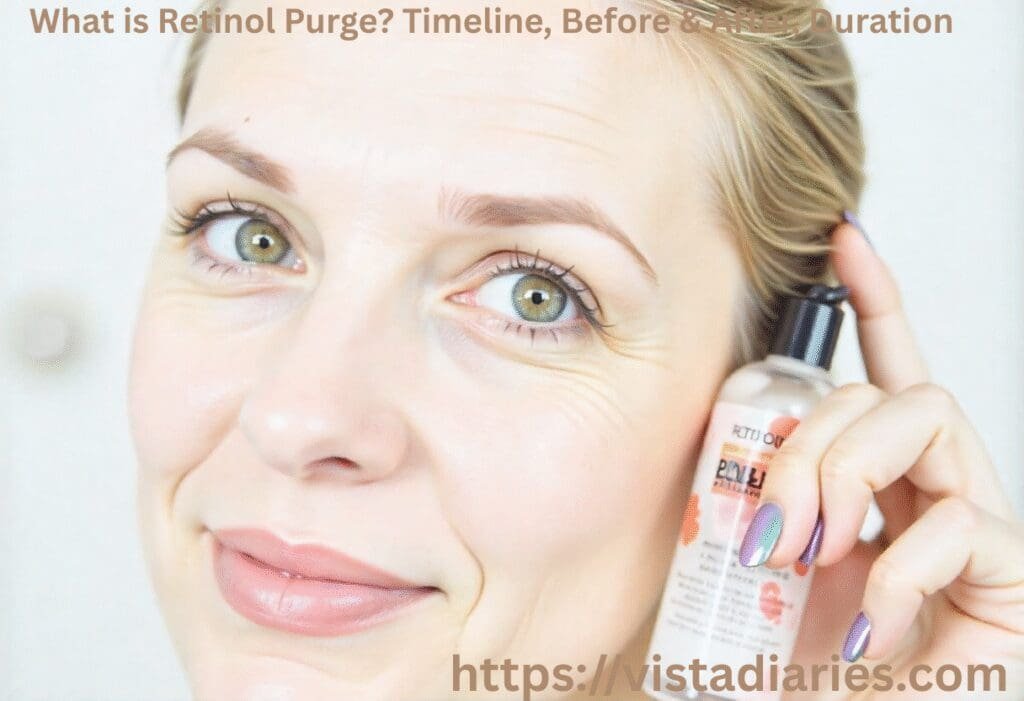 What is Retinol Purge? Timeline, Before & After, Duration